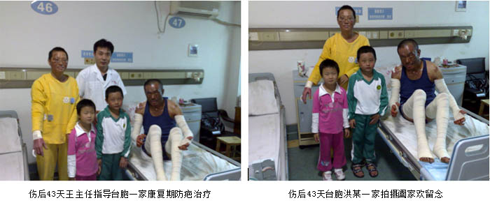 9170金沙集团_皮肤原位再外行艺乐成救治大面积严重烧伤台胞一家四口