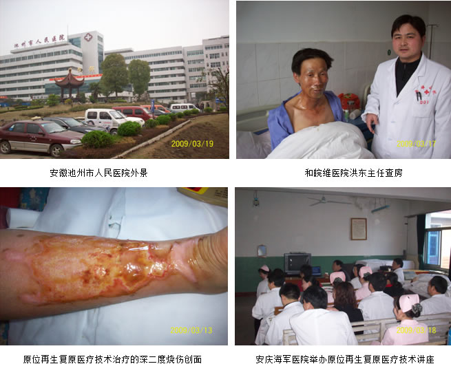 9170金沙集团_皮肤原位再生回复医疗手艺在皖南普及