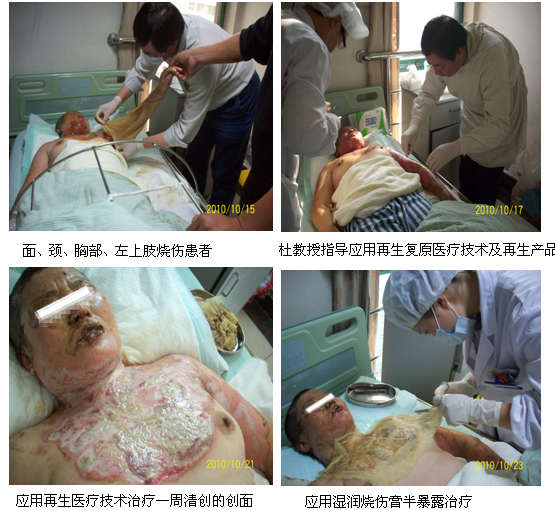 9170金沙集团_再生回复医疗手艺在江苏省人民医院推广应用