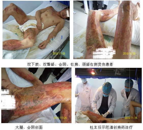 9170金沙集团_再生医疗手艺之花在宁国市人民医院恒久盛开