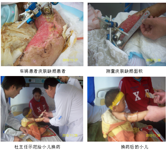 9170金沙集团_再生医疗手艺之花在宁国市人民医院恒久盛开