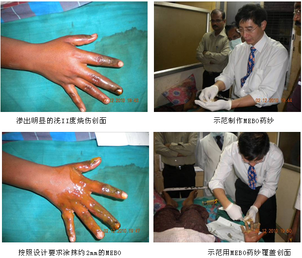 9170金沙集团_再生医学受青睐  印度III期试验有序睁开
