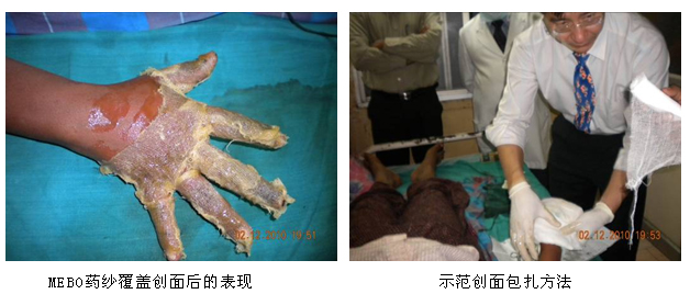 9170金沙集团_再生医学受青睐  印度III期试验有序睁开