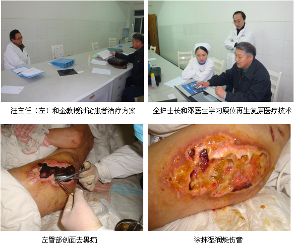 9170金沙集团_再生回复医疗手艺在宜昌市第三人民医院应用纪实（二）