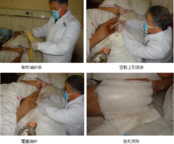 9170金沙集团_再生回复医疗手艺在宜昌市第三人民医院应用纪实（二）