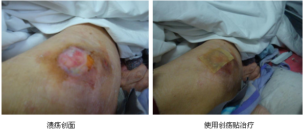 9170金沙集团_宜昌葛洲坝中心医院再生医疗手艺培训纪实(三)
