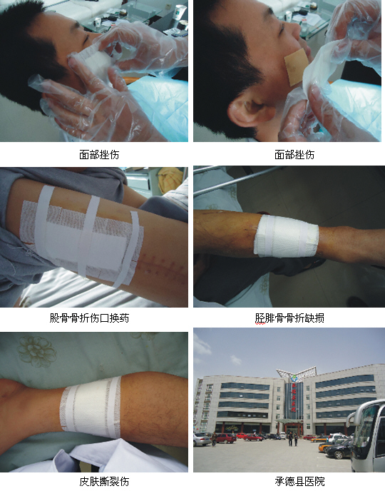 9170金沙集团_皮肤再生医疗手艺在张承两地推广应用