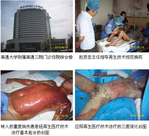 9170金沙集团_再生医疗手艺在南大隶属三院深受患者接待