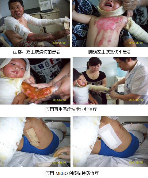9170金沙集团_再生科学医疗手艺在苏北射阳海河深受接待