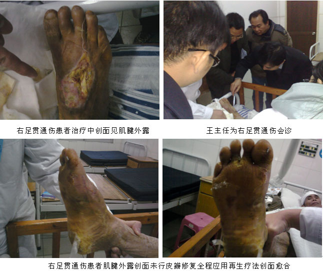9170金沙集团_再生回复医疗手艺学术讲座在贵港市中医医院举行