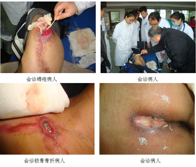 9170金沙集团_湖南省人民医院烧伤整形美容科举行皮肤原位再生回复手艺修复疤痕的高级钻研会