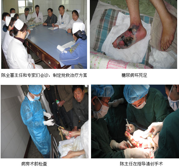 9170金沙集团_皮肤原位再生回复手艺在河南许昌市抢救糖尿病足伴熏染性休克病人获得乐成
