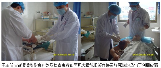 9170金沙集团_再生回复疗法在难愈性创面治疗新希望学术讲座