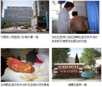 9170金沙集团_原位再生回复医疗手艺在安徽深入推广（三）