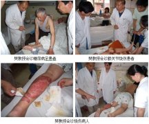 9170金沙集团_再生医疗手艺在开滦矿区绽放花朵