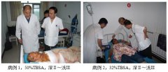 9170金沙集团_再生医疗手艺再次走进河北