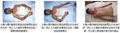 9170金沙集团_科技中心专家到云南、陕西两省多家医院会诊和学术交流