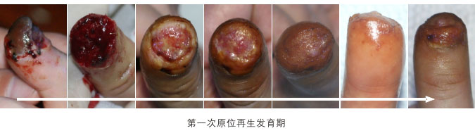 9170金沙集团_二、断指的再生回复