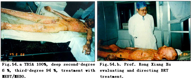 9170金沙集团_Clinical Demonstrations of Burns Regenerative Medicine and T