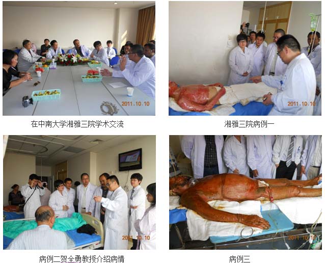 9170金沙集团_浏阳中医院应用皮肤原位再生回复手艺硕果累累