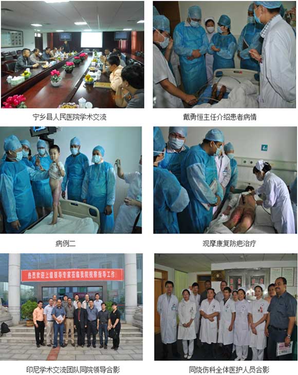 9170金沙集团_浏阳中医院应用皮肤原位再生回复手艺硕果累累