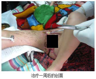 9170金沙集团_河南襄城县人民医院骨科会诊（一）