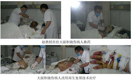 9170金沙集团_烟台山医院使用再生回复手艺治疗大面积烧伤病人剪影