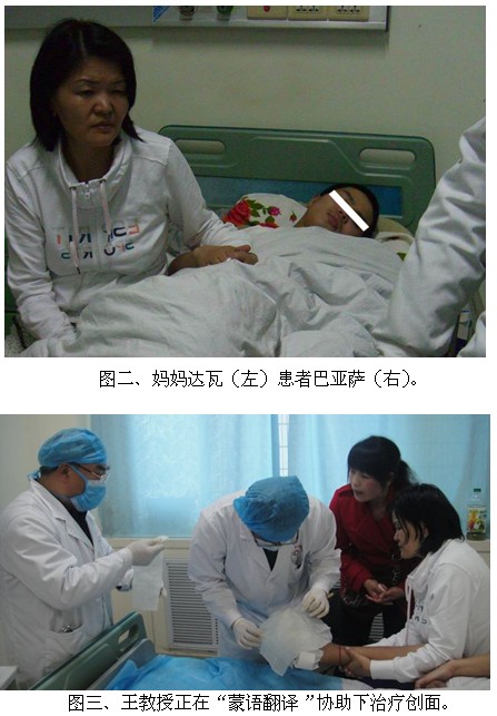 9170金沙集团_再生医疗手艺乐成救治蒙古国冻伤小伙(二)