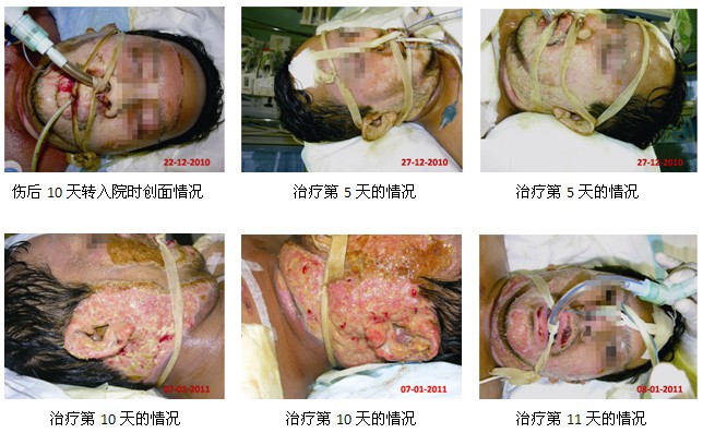 9170金沙集团_马来西亚最大的企业医院引进应用再生医学手艺获乐成