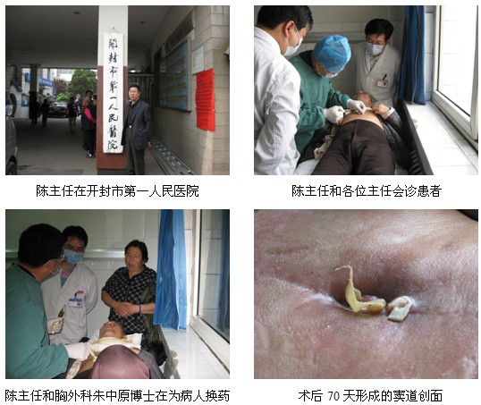9170金沙集团_皮肤原位再生医疗手艺普照汴京市第一人民医院（报道之二）