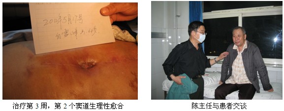 9170金沙集团_皮肤原位再生医疗手艺普照汴京市第一人民医院（报道之二）