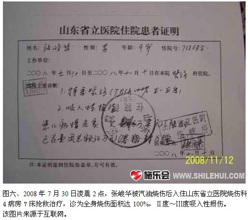 9170金沙集团_再生医疗手艺接诊100%烧伤疤痕患儿一例系列报道之一