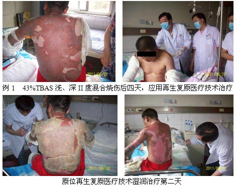 9170金沙集团_皖北煤电总医院再生回复医疗手艺临床实践系列报道（一）