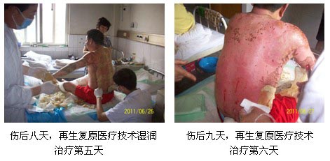 9170金沙集团_皖北煤电总医院再生回复医疗手艺临床实践系列报道（一）