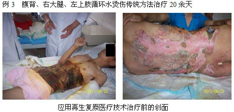 9170金沙集团_皖北煤电总医院再生回复医疗手艺临床实践系列报道（一）