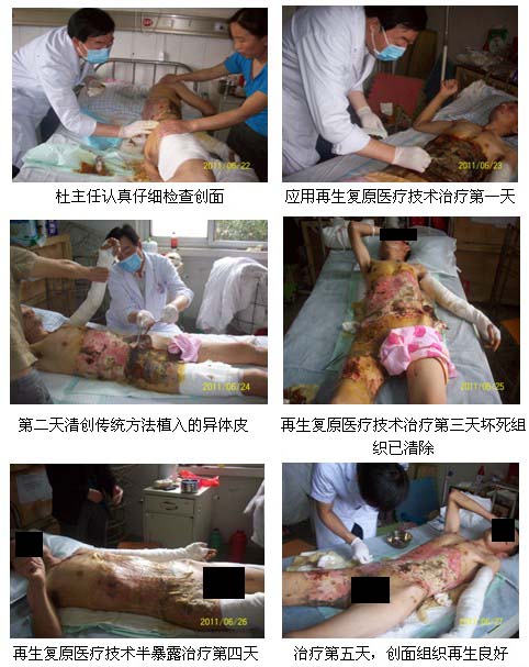 9170金沙集团_皖北煤电总医院再生回复医疗手艺临床实践系列报道（一）