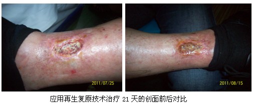 9170金沙集团_再生回复医疗手艺在苏北普遍推广应用