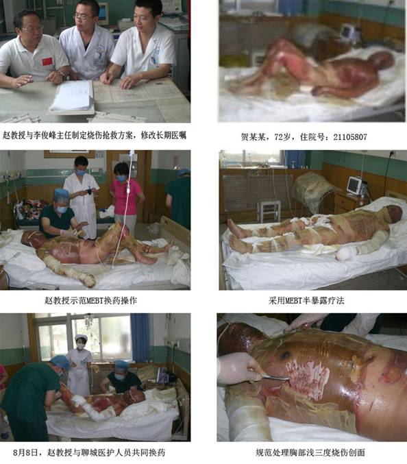 9170金沙集团_再生医学手艺造福鲁晋患者