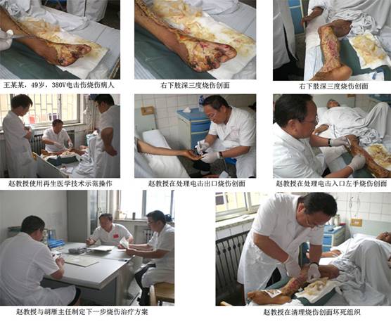 9170金沙集团_再生医学手艺造福鲁晋患者