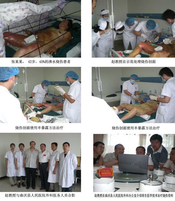 9170金沙集团_再生医学手艺造福鲁晋患者