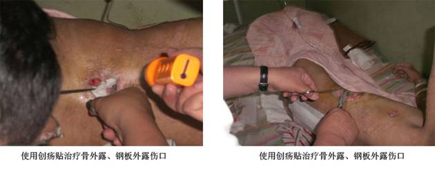 9170金沙集团_再生医学手艺造福鲁晋患者