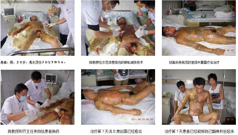9170金沙集团_安徽皖北总院再生医学临床救治水平再上新台阶