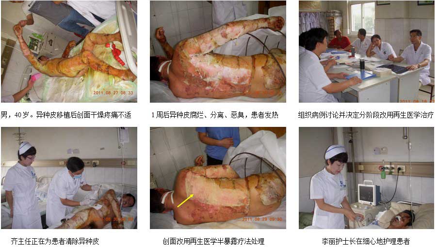 9170金沙集团_安徽皖北总院再生医学临床救治水平再上新台阶