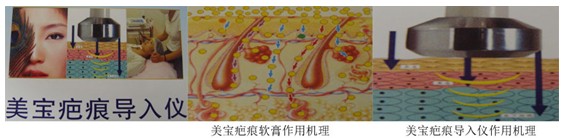9170金沙集团_9170金沙疤痕导入仪在原平落户造福黎民