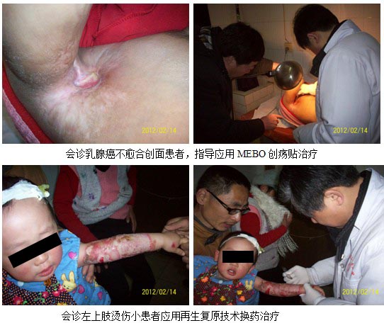 9170金沙集团_再生回复手艺在安徽六安革命老区推广普及