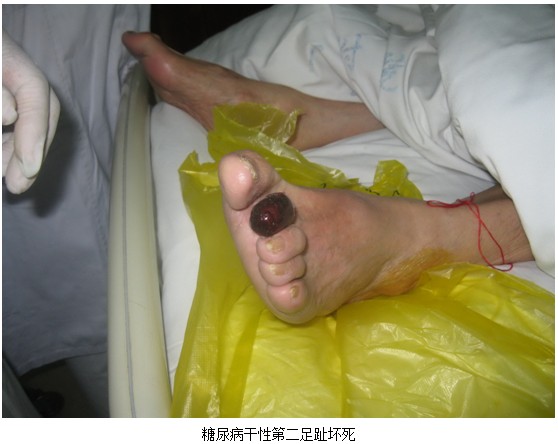 9170金沙集团_皮肤原位再生回复医疗手艺在郑州大学第一隶属医院临床应用