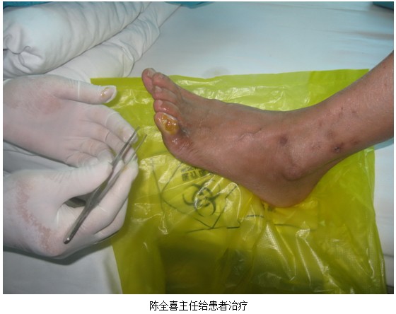 9170金沙集团_皮肤原位再生回复医疗手艺在郑州大学第一隶属医院临床应用