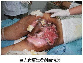 9170金沙集团_再生医疗手艺在重庆市九龙坡区第二人民医院深入推广