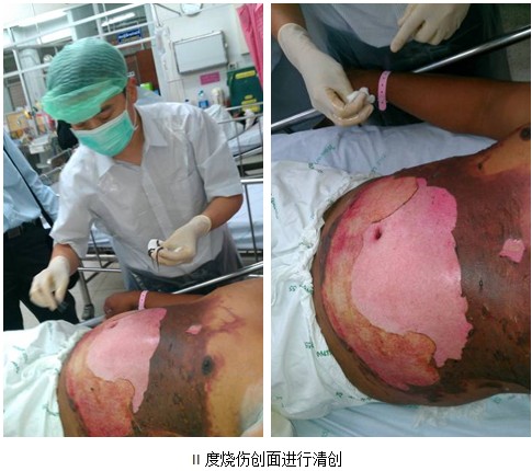 9170金沙集团_泰国着力开展再生医疗手艺多学科应用