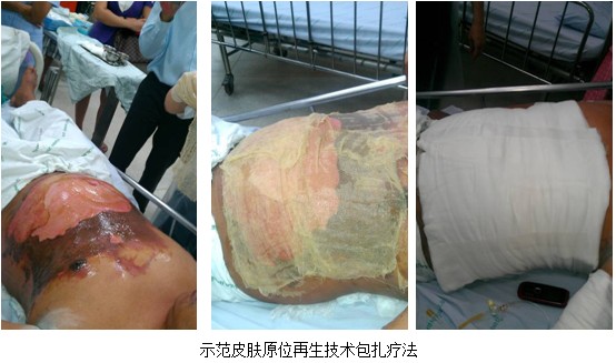 9170金沙集团_泰国着力开展再生医疗手艺多学科应用